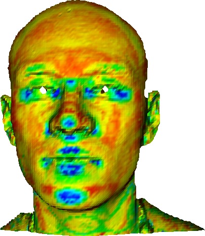 Automatic Keypoint Detection on 3D Faces Using a Dictionary of Local Shapes